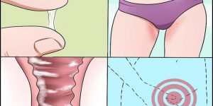 causas da candidiase vaginal