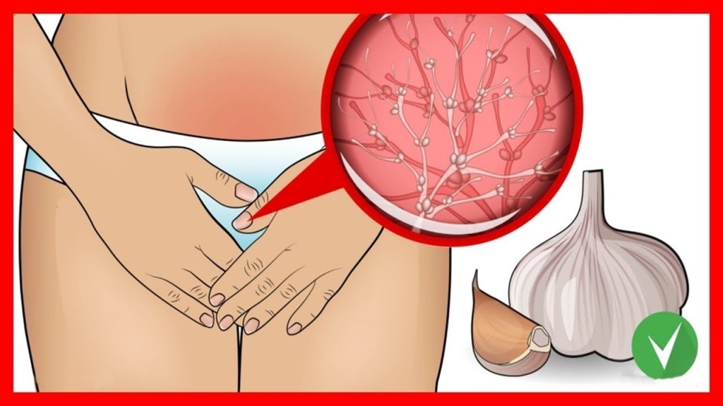 receitas para acabar com infecção vaginal