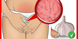 receitas para acabar com infecção vaginal