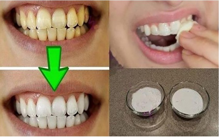 mistura para clarear os dentes